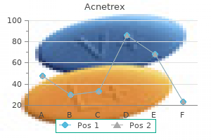 discount acnetrex line