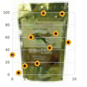 Hemifacial atrophy agenesis of the caudate nucleus